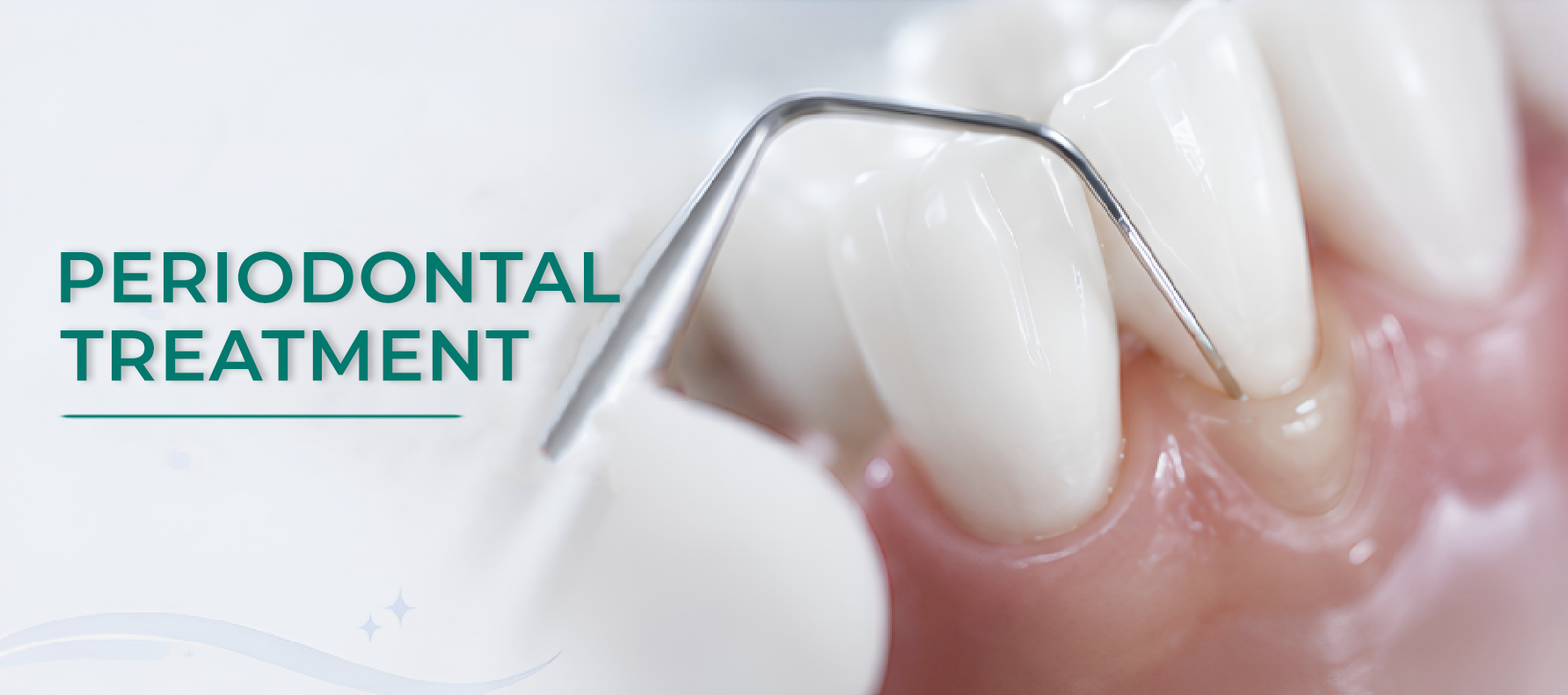 Periodontal Treatment hero banner