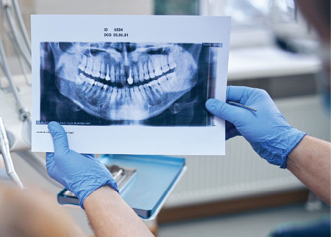 Dentist reviewing a dental panoramic X-ray