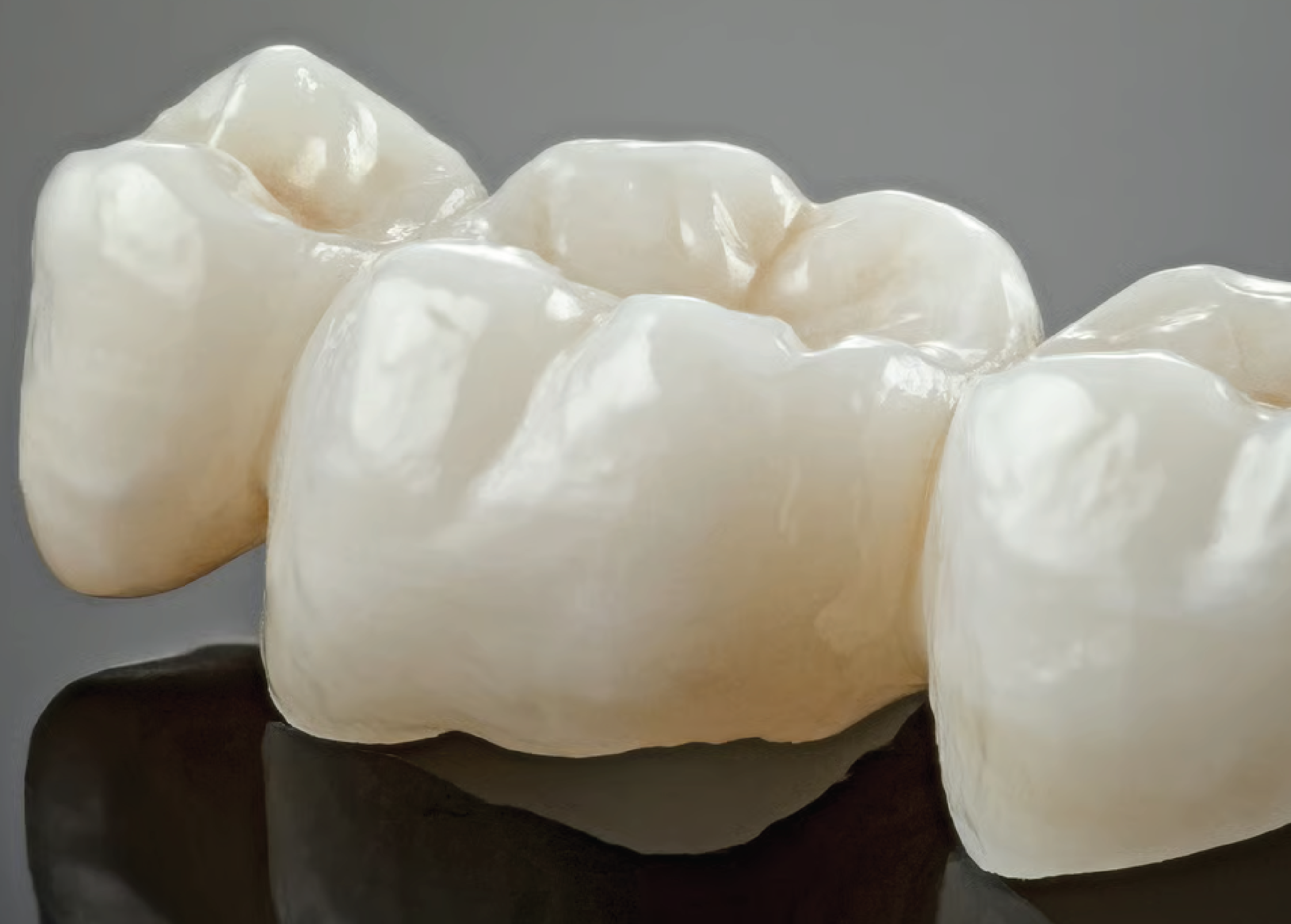 Dental crowns and bridges