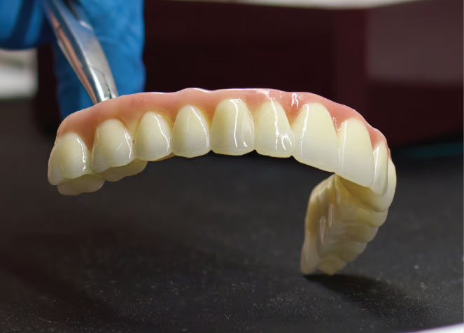 Dentures